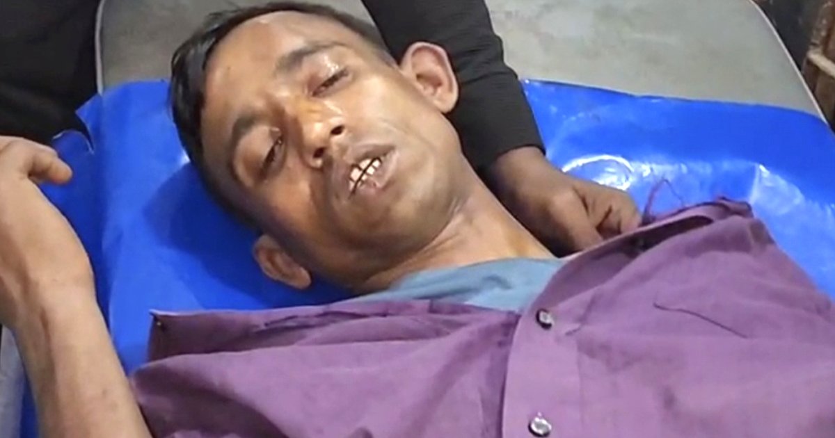 স্বতন্ত্র প্রার্থীর লিফলেট বিতরণের সময় প্রতিবন্ধী যুবককে মারধরের অভিযোগ