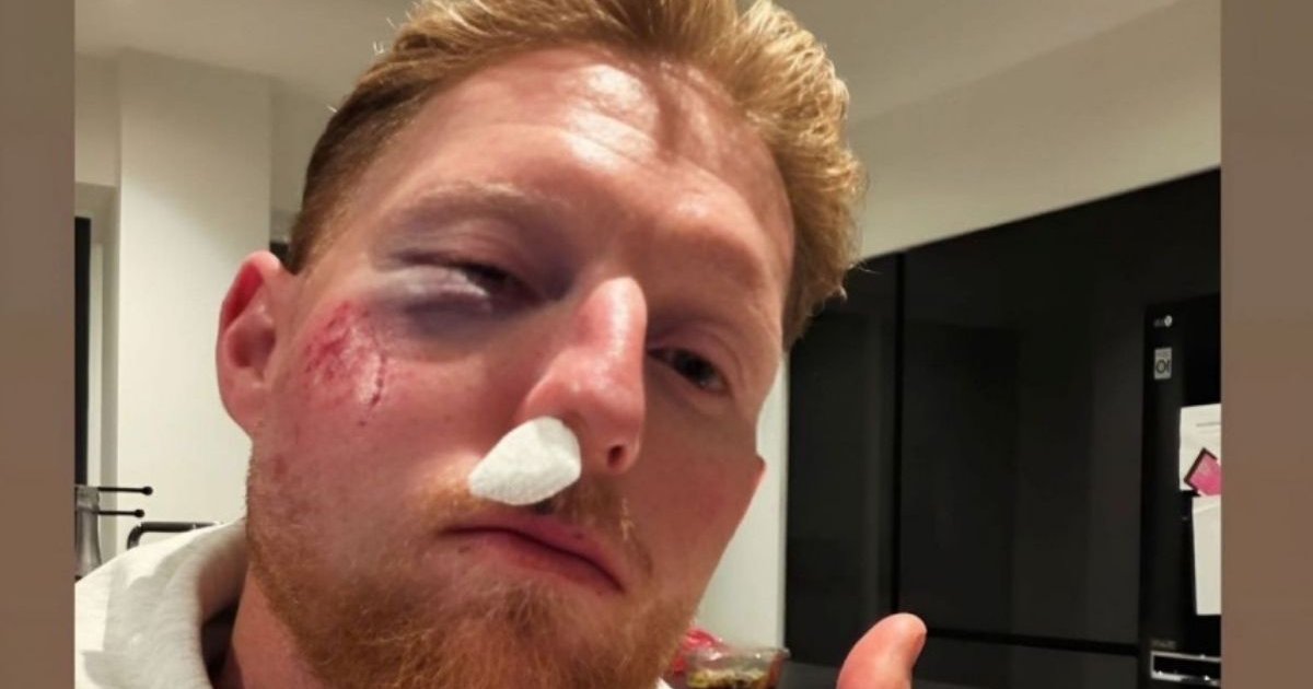 বলের আঘাতে গুরুতর চোটে ইংল্যান্ডের অধিনায়ক বেন স্টোকস