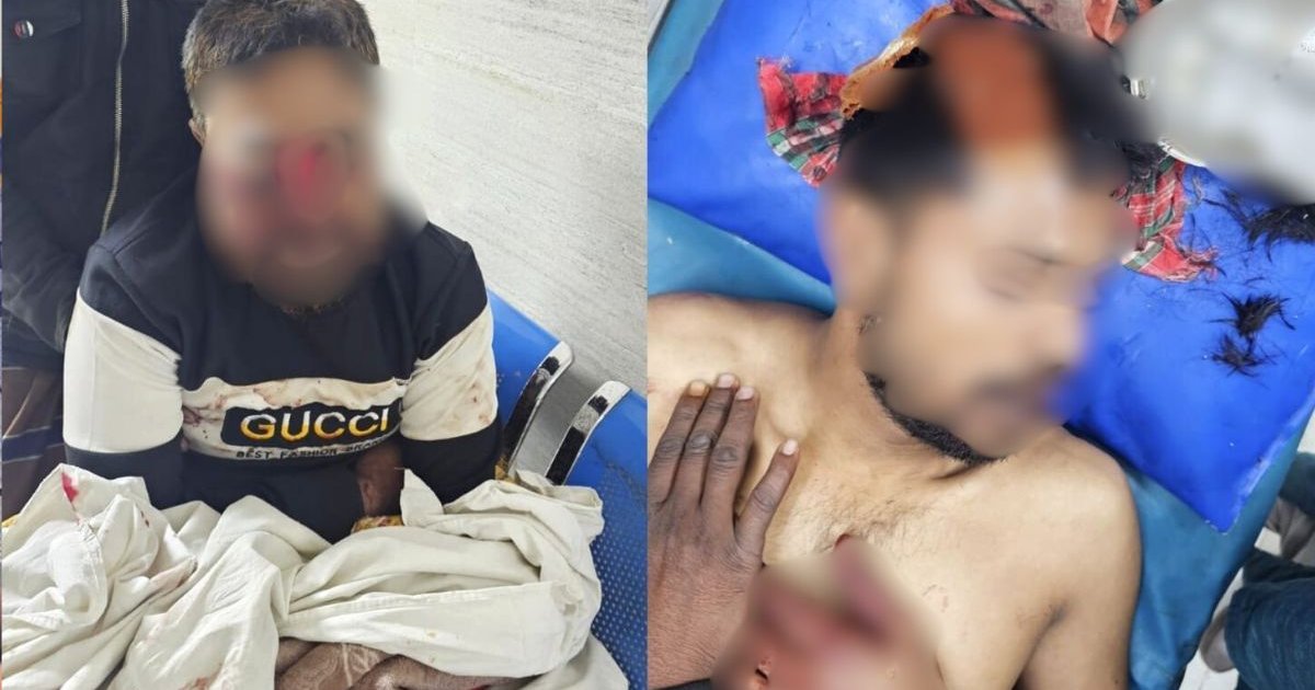 ভোটারদের টাকা বিতরণকে কেন্দ্র করে বিএনপি-জামায়াত সংঘর্ষ