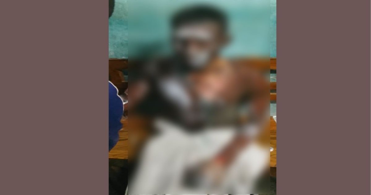 বিয়ের প্রস্তাব প্রত্যাখ্যান, নিজ গায়ে পেট্রল ঢেলে আত্মহত্যার চেষ্টা প্রেমিকের