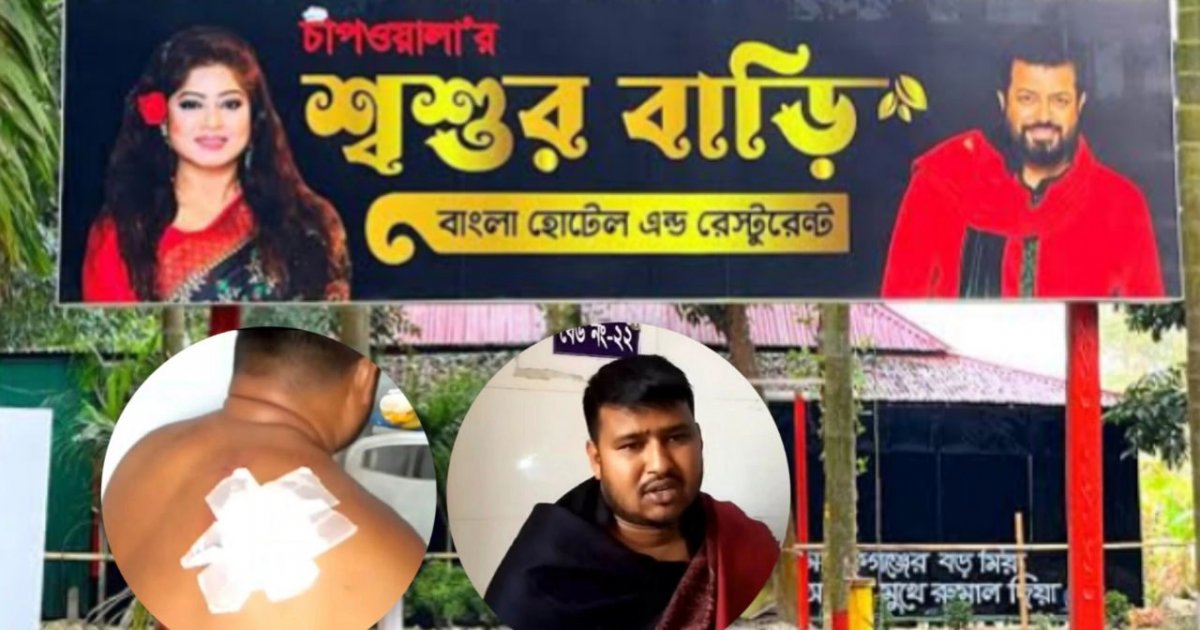 ওমর সানীর রেস্তোরাঁয় কাস্টমারকে কুপিয়ে জখম