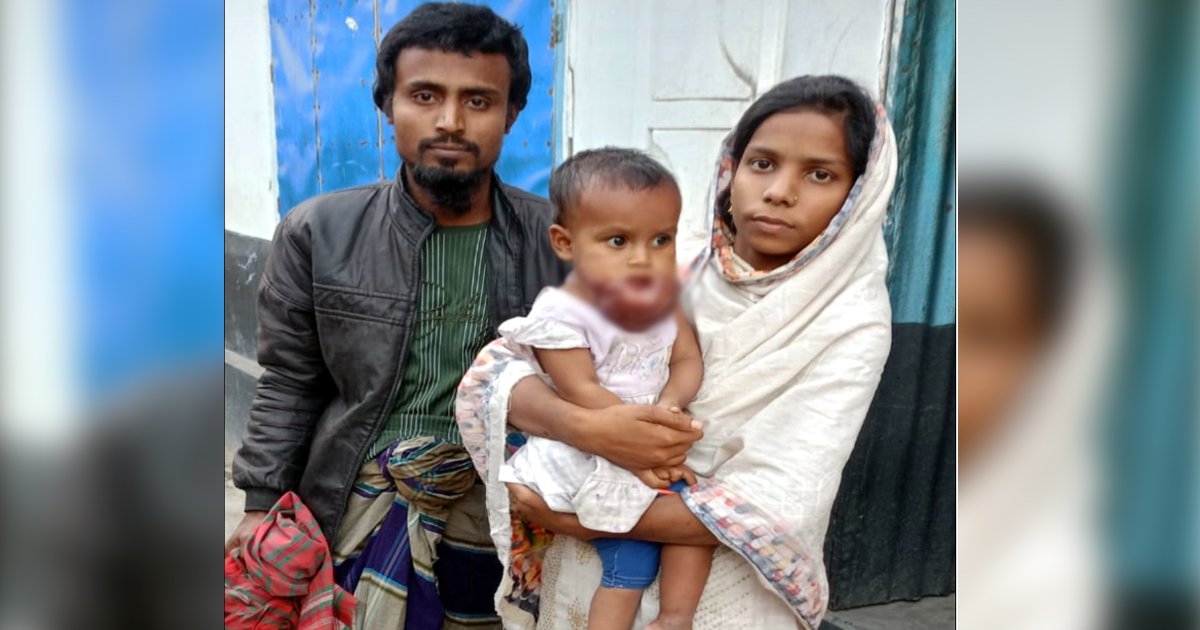 সর্বস্বান্ত বাবা, সহযোগিতা পেলে বাঁচতে পারে শিশু জান্নাত