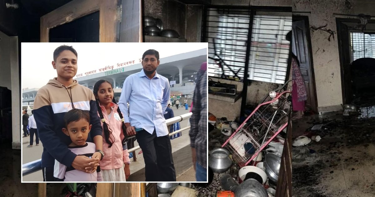 দগ্ধ তিন শিশু জানে না পরিবারের কেউ বেঁচে নেই