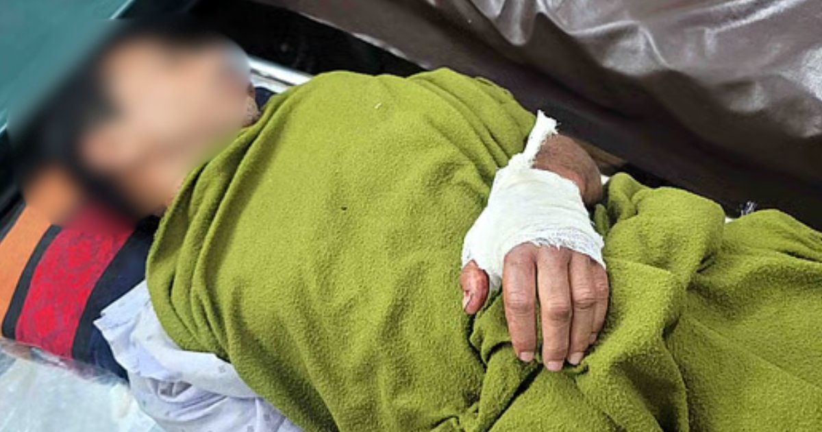 মেয়েকে উত্যক্তের প্রতিবাদ করায় বাবাকে তুলে নিয়ে হাত ভেঙে দিয়েছে বখাটেরা