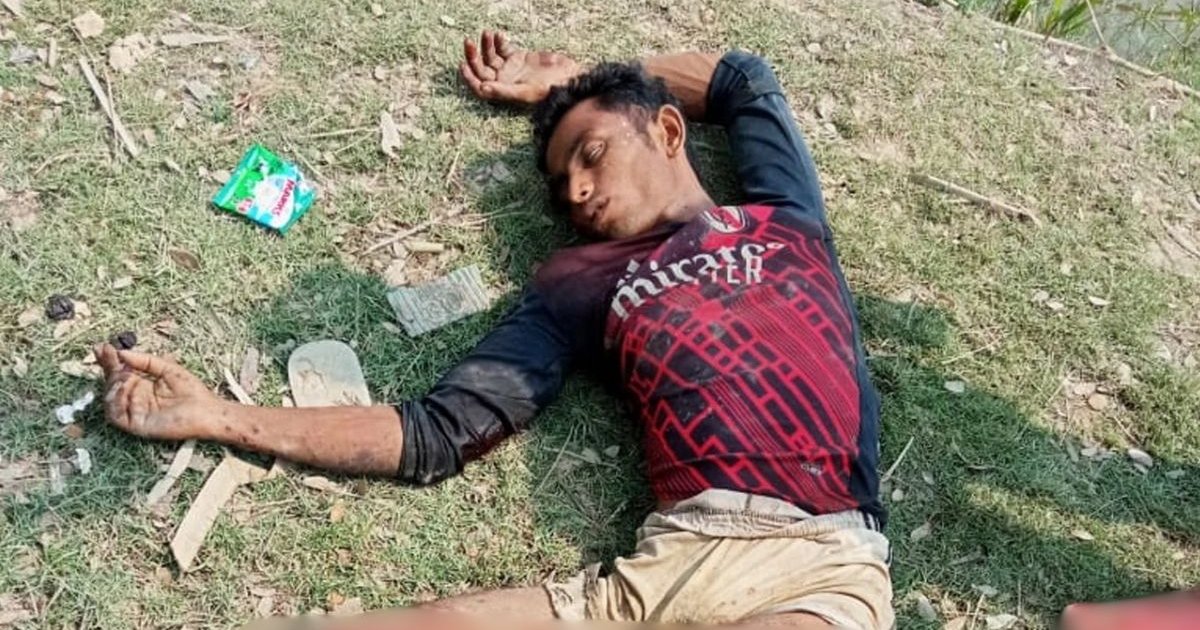 উখিয়া সীমান্তে আবারও ল্যান্ডমাইন বিস্ফোরণ: রোহিঙ্গা যুবকের পা বিচ্ছিন্ন, হাসপাতালে চিকিৎসা