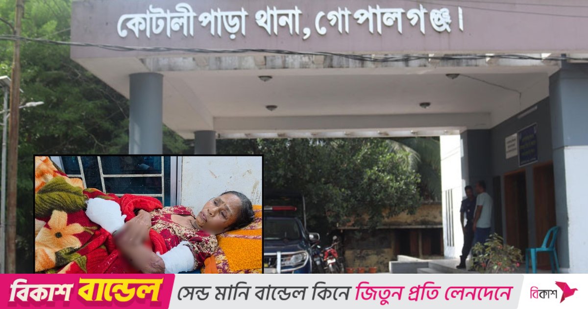 গোপালগঞ্জে ভাঙারি মালামাল কুড়াতে গিয়ে ককটেল বিস্ফোরণ, নারী আহত 