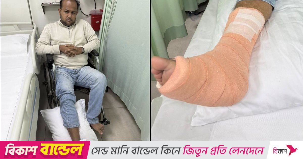 সিঁড়ি দিয়ে নামতে গিয়ে পা ভাঙলেন ঢাবি ছাত্রদল নেতা হামীম
