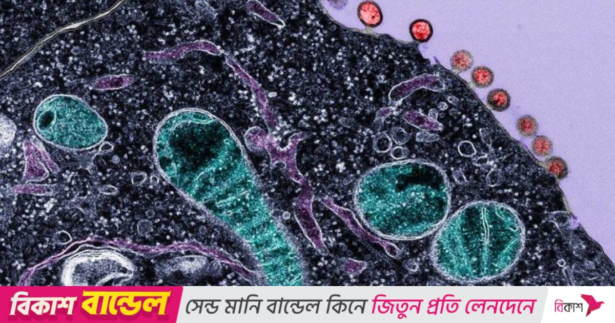 এইডস চিকিৎসায় আশার আলো, ১৮ মাস ওষুধ না খেয়েও সুস্থ ৭ রোগী