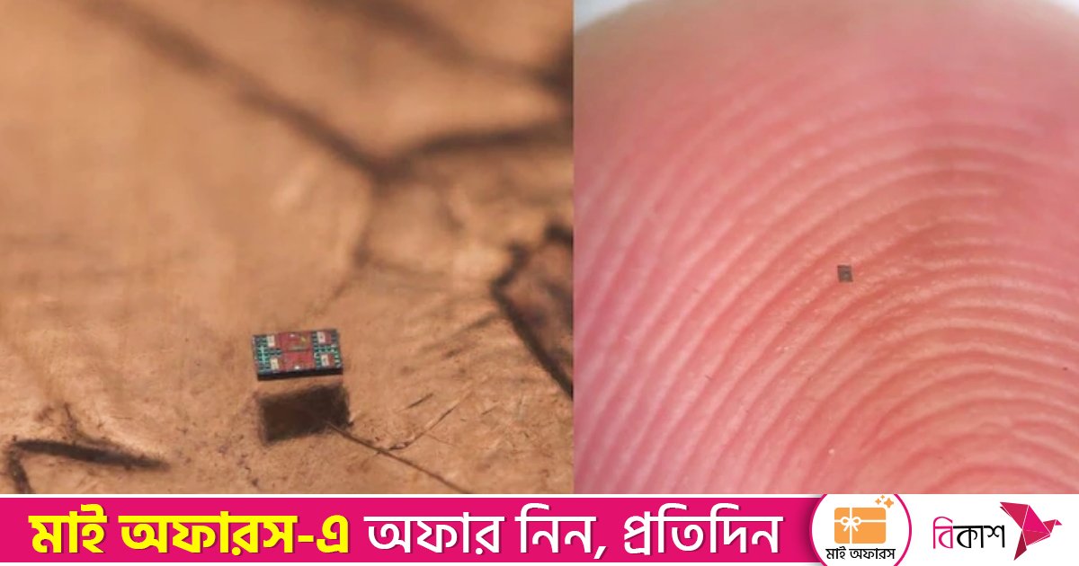 নিজের চিকিৎসা নিজেই করতে পারে বিশ্বের ক্ষুদ্রতম রোবট