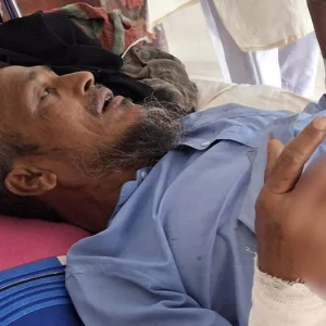 ভেবেছিলেন টর্চলাইট, সুইচ চাপতেই বিস্ফোরণে দগ্ধ