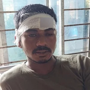 সিগারেটের দাম নিয়ে বাগবিতণ্ডা, ক্রেতার মাথা ফাটালেন বিক্রেতা