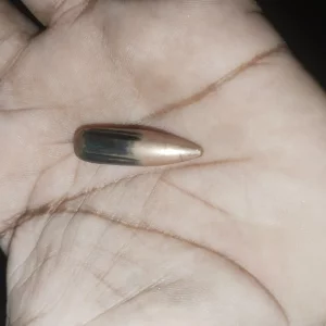 মিয়ানমার সীমান্ত থেকে আসা গুলিতে আহত বাংলাদেশি নারী, উদ্ধার তাজা গুলিও