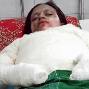 শরীরে ডিজেল ঢেলে গৃহবধূকে পুড়িয়ে হত্যার অভিযোগ