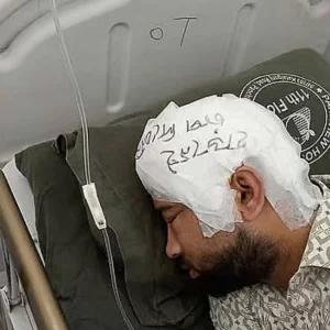 ফ্রিজে রাখা খুলি দুই মাস পর লাগানো হলো মামুনের মাথায়