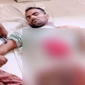 সীমান্তে বিএসএফের গুলিতে বাংলাদেশি যুবক আহত