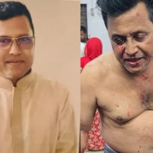 কুষ্টিয়ায় আওয়ামী লীগ নেতা গুলিবিদ্ধ