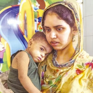 ১৯ দিনে হামের উপসর্গে ৯৪ শিশুর মৃত্যু, আক্রান্ত ৫৭৯২