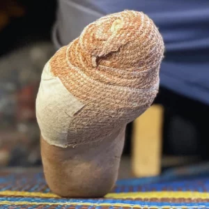 গাজার আশ্রয়শিবিরে ঘুমন্ত মুসলিমদের শরীর কামড়ে খাচ্ছে ইঁদুর