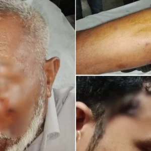 পদ্মা নদীতে টহলরত নৌ পুলিশের ওপর হামলা, ওসিসহ ৫ সদস্য গুলিবিদ্ধ