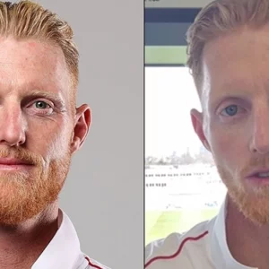 ভয়াবহ ইনজুরির পর বদলে গেছে বেন স্টোকসের চেহারা