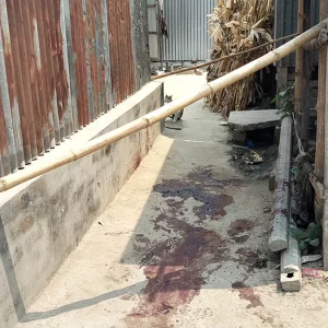 চরভদ্রাসনে যুবকের হাত-পা বিচ্ছিন্নের ঘটনায় মামলা, অবস্থা আশঙ্কাজনক