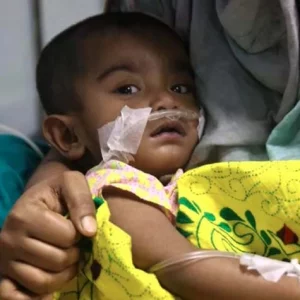 দেশজুড়ে হামের ভয়াবহ প্রাদুর্ভাবে ২৫০-এর বেশি শিশুর মৃত্যু