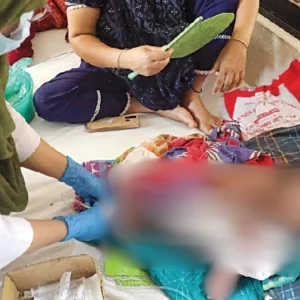 হাম ও হামের উপসর্গে আরও ১০ শিশুর মৃত্যু