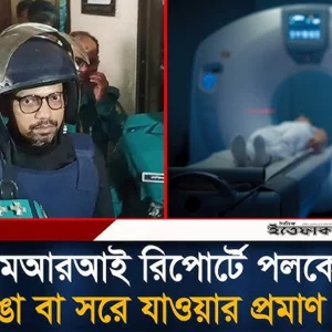 এমআরআই রিপোর্টে পলকের হাড় ভা/ঙা বা সরে যাওয়ার প্রমাণ মেলেনি