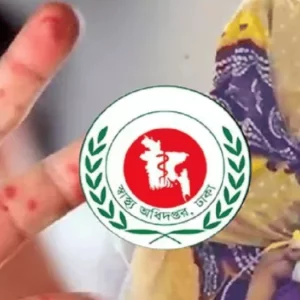 ময়মনসিংহ-সিলেটে হামের উপসর্গে চার শিশুর মৃত্যু