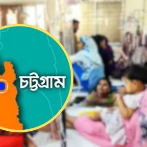 বেসরকারি হাসপাতালেও হাম রোগী ভর্তি নেওয়ার নির্দেশ 