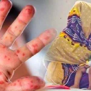 গোষ্ঠীগত প্রতিরোধক্ষমতা তৈরি না হলে হামে আক্রান্ত 