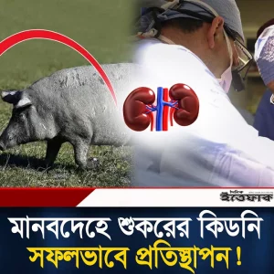 বিজ্ঞানীদের বিষ্ময়কর কাণ্ড; মানবদেহে শুকরের কিডনি-লিভার, কাজ করল নিখুঁতভাবে!