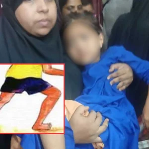 পাগলা কুকুরের কামড়ে পটুয়াখালীতে শিশুসহ আহত ১০