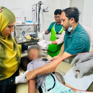 শিশুর পেট থেকে অস্ত্রোপচার ছাড়াই বের করা হলো ৫ টাকার কয়েন