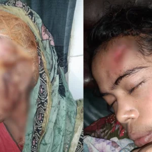 বিশ্বকাপ ফাইনাল নিয়ে চেঁচামেচি, চুপ করতে বলায় মা-মেয়ের ওপর হামলা
