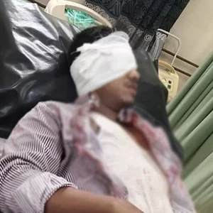 সিরাজগঞ্জে চলন্ত ট্রেনে পাথর নিক্ষেপ, যাত্রীর চোখে গুরুতর জখম