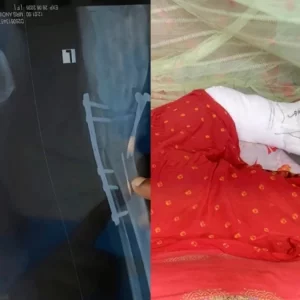 মেশিনের ফলা রেখে রোগীর পায়ে সেলাইয়ের ঘটনা তদন্তে কমিটি গঠন