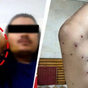 আন্দোলনকারীদের শরীরে গুলির আঘাতের প্রমাণ, অস্বীকার পুলিশের
