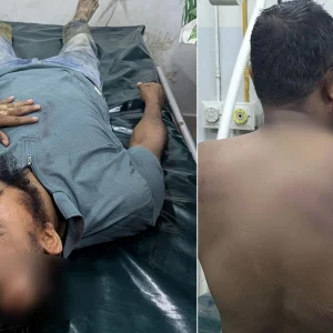 বনের জমিতে পানের বরজ, উচ্ছেদে গিয়ে হামলার শিকার ৫ বনকর্মী