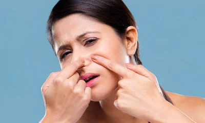 ব্রণ থাকলে কি মেকআপ করবেন