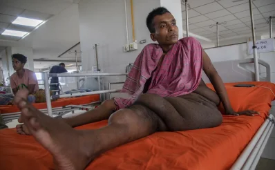 শেখ হাসিনা জাতীয় বার্ণ এন্ড প্লাস্টিক সার্জারি ইনস্টিটিউটে চিকিৎসা নিতে আসা রোগী। ছবি :  আবদুল গণি