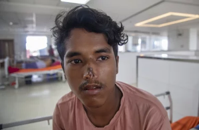 শেখ হাসিনা জাতীয় বার্ণ এন্ড প্লাস্টিক সার্জারি ইনস্টিটিউটে চিকিৎসা নিতে আসা এক রোগী। ছবি :  আবদুল গণি