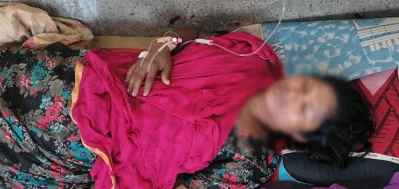 নির্যাতনের শিকার ওই নারী খুলনা মেডিক্যাল কলেজ হাসপাতালে চিকিৎসাধীন। ছবি: ইত্তেফাক