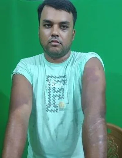 নির্যাতনের শিকার ভুক্তভোগী সাদ্দাম চোকদার। ছবি: সংগৃহীত