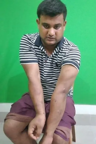 নির্যাতনের শিকার ভুক্তভোগী বকুল চোকদার। ছবি: সংগৃহীত