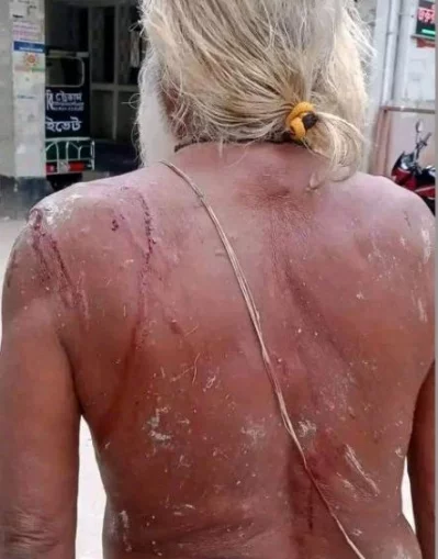 হামলার পর রাধাপদ রায়। ছবি: সংগৃহীত