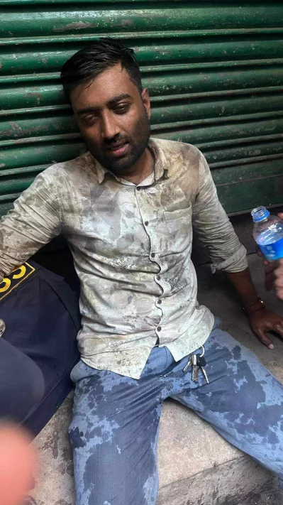 সমাবেশে আহত দৈনিক ইত্তেফাকের রিপোর্টার তানভীর আহাম্মদ। ছবি: ইত্তেফাক