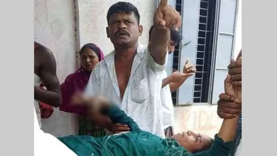 আহত শিক্ষার্থী। ছবি: ইত্তেফাক