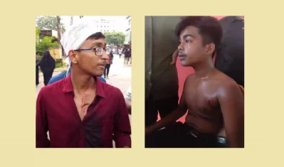 গুলিবিদ্ধ দুই শিক্ষার্থী | ছবি: সংগৃহীত 