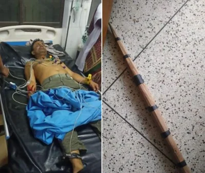 হাসপাতালে চিকিৎসাধীন রকিব লিখন। পাশের লাঠি দিয়ে আঘাত করা হয়